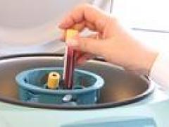 Sangre en tubos de ensayo, en una centrifugadora.