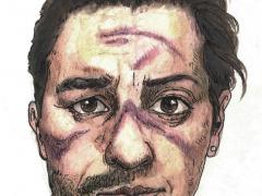 Protegerse también es doloroso. Las marcas de la batalla son evidentes. Ilustración: Miguel Sifuentes.