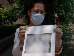 María Candelaria muestra las radiografías de su hermana Ángeles Bueno. Fotografía: María Ruiz.