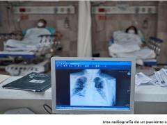 Una radiografía de un paciente con COVID-19, revista Proceso. Fotografía: Iván Macías.